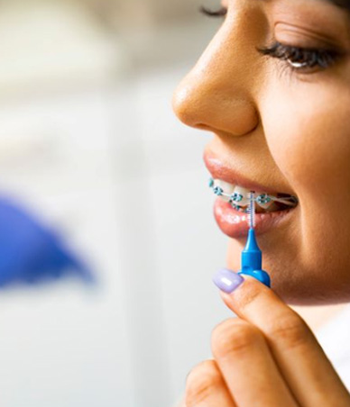 Young woman using interdental brush to clean around her braces