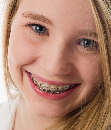 Smiling teenage girl with clear ceramic braces