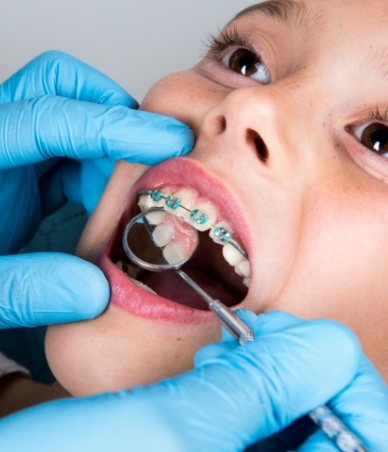 Houston emergency orthodontist examining a patient with braces