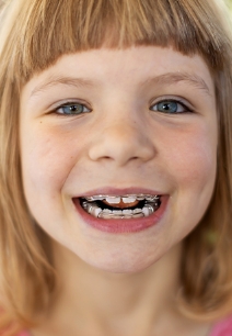 Young girl with braces grinning