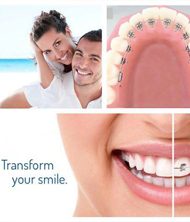 Collage of people smiling with lingual braces