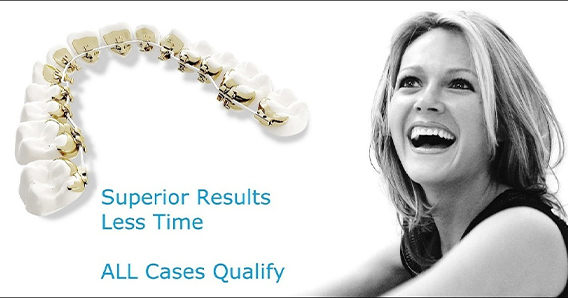 Woman with lingual braces smiling with text that reads superior results less time all cases qualify