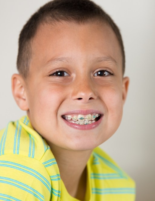 Yong boy smiling with braces for Phase 1 orthodontic treatment in Houston
