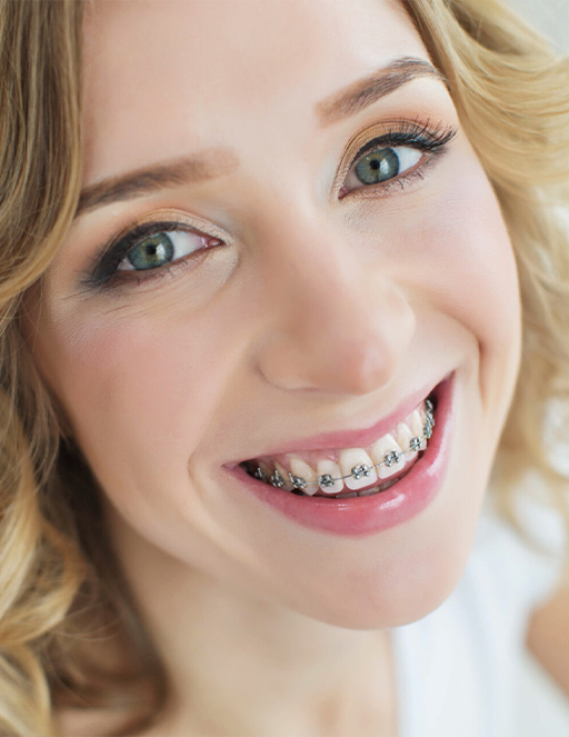 Young woman smiling with traditional braces in Houston