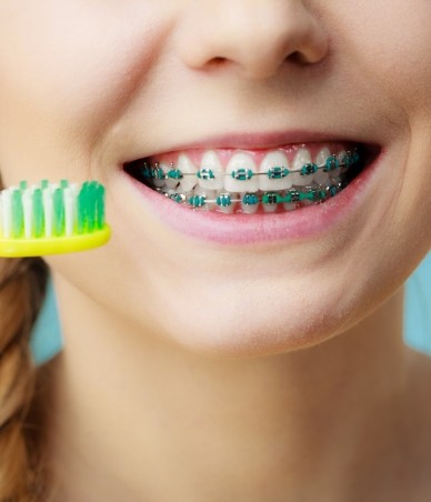 Girl with braces smiling and holding toothbrush